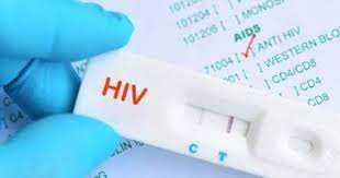 Find information on hiv aids here! Ø§Ø·Ù…Ù† Ø¹Ù„Ù‰ Ù†ÙØ³Ùƒ 3 Ø£Ù†ÙˆØ§Ø¹ Ù„Ø§Ø®ØªØ¨Ø§Ø± Hiv Ù„ÙØ­Øµ Ø§Ù„ÙÙŠØ±ÙˆØ³ Ø§Ù„Ù…Ø±ØªØ¨Ø· Ø¨Ø§Ù„Ø¥ÙŠØ¯Ø² Ø§Ù„ÙŠÙˆÙ… Ø§Ù„Ø³Ø§Ø¨Ø¹