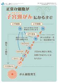 ボード 女性診療科 産科 obstetrics and gynecology のピン