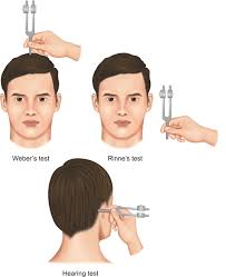 Image result for Tuning Fork Test