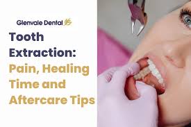Image result for Tooth Extraction