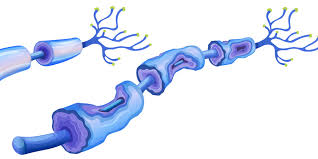 At first you may have Diagnosis And Treatment Of Guillain Barre Syndrome Journal Of Ethics American Medical Association