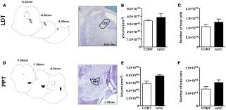 Maybe you would like to learn more about one of these? Stereological Data Of Ldt And Ppt Regions No Major Differences Were Download Scientific Diagram