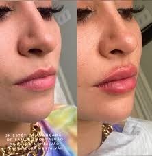 Vocês não imaginam a algazarra que a gente fez pra deixar tudo pronto. Bianca Andrade Faz Cirurgias Esteticas E Exibe Antes E Depois Rd1