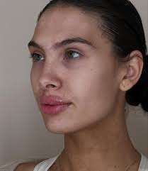 Swipe ⬅️ Beautiful before. Beautiful, plump, & hydrated after.  👩‍⚕️Savannah Klein, MSN, NP-BC 💉Certified Injector ✨Alani Skin MD  Scottsdale 📍7246 E 1st Street suite 102 📞 480-993-2218 🔗 booking link in  bio