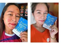 Collagen is not a magical supplement, and it does not work a miracle overnight. Frozen Collagen Whitening Capsule Lovely Attraction Facebook