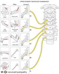 Pin By Bill Osburn On Exercise In 2020 Spine Health Medical Anatomy Plexus Products