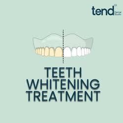 Teeth Whitening Treatment in Jubilee Hills, Hyderabad product image