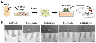 Cells Free Full Text Intrathymic Selection And Defects In The Thymic Epithelial Cell Development Html