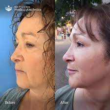 Our mission is to elevate compounding industry standards through a unique combination of superior science and service. San Francisco Medical Aesthetics Home Facebook