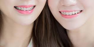 Maybe you would like to learn more about one of these? 6 Jenis Behel Untuk Atasi Gigi Tonggos