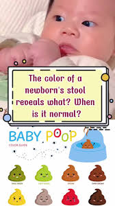 Image result for Newborn Stool Color