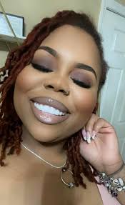 Veneers at Smile Dental Center in Miami