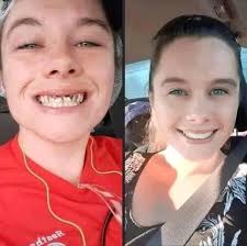 ニューヨーク市のアンバサダーホテルでマリリン・モンロー(1955年)