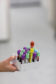 Chronisch Lymphatische Leukamie Cll Das K Wort