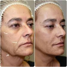 Dr. Edward Serrano Médico estético, Sabadell