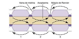 The pathophysiology of multiple sclerosis: Fisiopatologia De La Esclerosis Multiple Que Sucede Cuando Se Une El Sistema Nervioso Central Y El Sistema Inmunologico