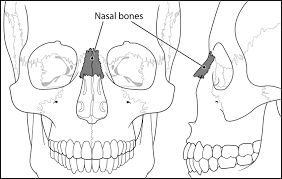 Basic Facial Anatomy Demonstrating Location Of Nasal Bones Download Scientific Diagram