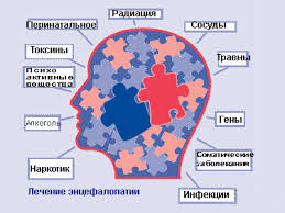 Расскажем, как лечится энцефалопатия головного мозга, к какому врачу обращаться при первых признаках. Encefalopatiya Chto Eto Takoe Vidy Prichiny Simptomy Lechenie Medicinskij Portal