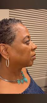 Reaction to a TV show scene where a character gets slapped