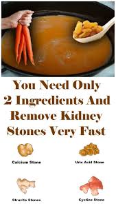 Pin On Healthy Tips