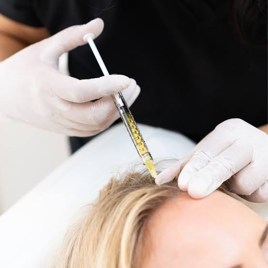 PRP, Polynucleotide & Exosome Hair Restoration Treatments London