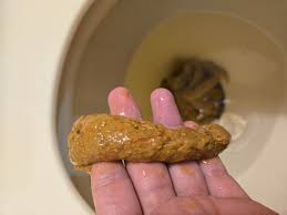 Image result for blood in stool human poop