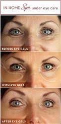 Getting rid of dark circles around the eyes tips