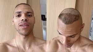 Litt vanskeligere enn å score mot et eller annet belgisk lag. Quand Braithwaite Se Fait Une Coupe A La Ronaldo