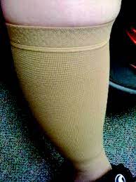 Jobst Stocking Definition Of Jobst Stocking By Medical Dictionary