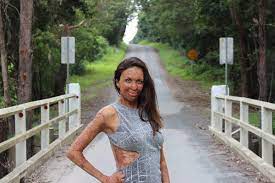 Turia pitt survived against extraordinary odds. Turia Pitt Wikipedia