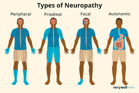 Image result for Peripheral Neuropathy