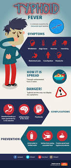 Most people in the united states with typhoid. 8 Things You Must Know About Typhoid Fever