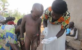Colorectal cancer is a disease in which malignant (cancer) cells form in the tissues of the colon or the rectum. Surgery On 100 Children Affected By Colon Cancer Globalgiving