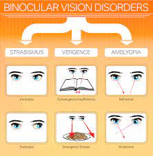 Signs And Symptoms Of Binocular Vision Problems