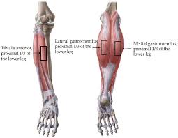 Gastrocnemius Medial Head Stiffness Is Associated with Potential Fall Risk  in Community-Dwelling Older Adults