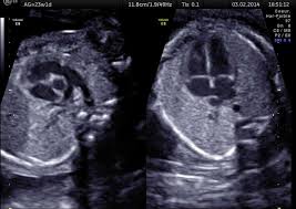 We did not find results for: Echographie Centre Gynecologie Aubagne