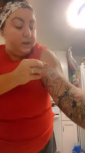 Placing a new Dexcom G6 sensor site! #diabetes #dexcomg6 #expressionmed  #diabetic #fyp