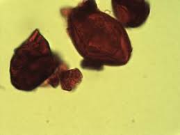 Image result for Cryptosepalum maraviense