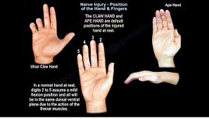 Image result for Normal Anatomic Position of the Hand and Wrist