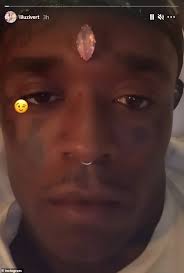Lil uzi vert diamond bleeding. Rapper Lil Uzi Vert Gets 11 Karat Pink Diamond Worth Upwards Of 24million Pierced To His Forehead Daily Mail Online
