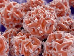 Treatment for leukemia has come a long way, but here are some things you may not know about the disease. Blood Cancer Discovery Helping Cardiovascular Patients Leukemia And Lymphoma Society