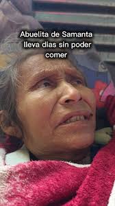 Abuelita de Samanta lleva dias sin poder comer😔