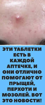 как убрать рубцы от прыщей на лице народные средства Eti Tabletki Est V Kazhdoj Aptechke I Oni Otlichno Pomogayut Ot Pryshej Perhoti I Mozolej Vot Eto Novosti Lechenie Perhoti Perhot Lechenie Pryshej