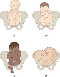 Image result for Shoulder Presentation