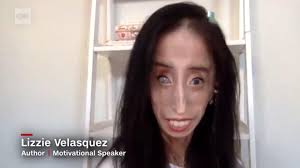Of course, cat man didn't forget to insert contact lenses. Parents On Tiktok Mock People With Disabilities For The New Teacher Challenge These Women Are Reclaiming Their Images