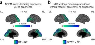 For centuries, people have questioned the meaning of dreams. The Neural Correlates Of Dreaming Nature Neuroscience