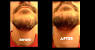 Just For Men Beard Dye Colors