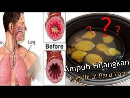 Tubuh terus membuat lendir (mukus) sepanjang waktu, dan bukan hanya di hidung. Cara Cepat Menghilangkan Lendir Diparu Paru Dahak Dan Batuk Secara Alami Youtube Obat Alami Paru Paru Herbal Alami