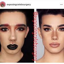 In order to view the gallery, please allow manage. What Do Ig Accounts Like Celebface Get Out Of Exposing Celebrity Surgery Dazed Beauty