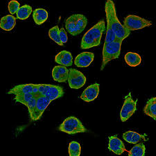 The publicly available database (www.proteinatlas.org) contains, in the first version, more than 400,000 high resolution. Cell Atlas Btk The Human Protein Atlas